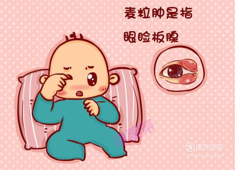 眼睛长麦粒肿怎么办如何快速根治看完你就知道了
