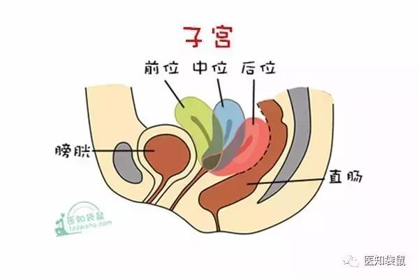 正常的子宫夹在膀胱与直肠之间,下端连接着阴道,宫颈,上端子宫体的