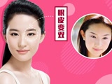 双眼皮防忽悠指南