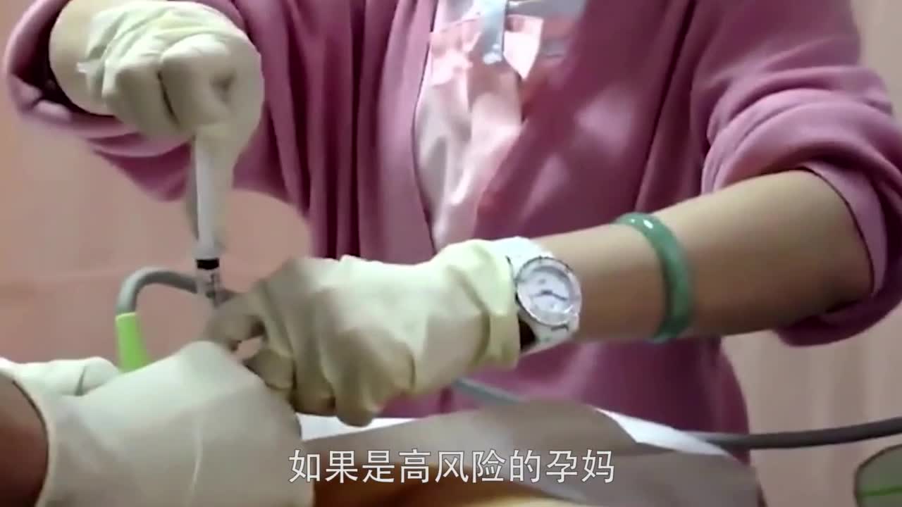 孕期大排畸检查的重要性