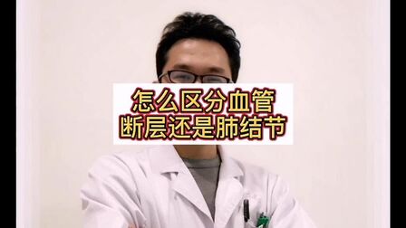 [图]胸部CT上如何区分是血管断层还是肺结节,听听放射科医生怎么说!