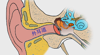 外耳道耵聍栓塞是怎么回事症状是什么严重吗