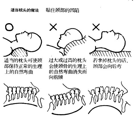 图解睡眠与颈椎病有何关系