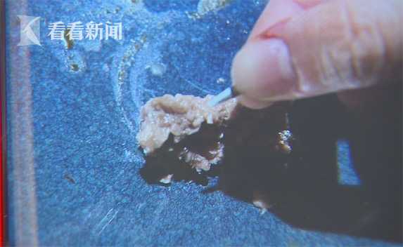 沪上知名网红火锅店吃出“刀尖” 食客惊魂未定 第1页