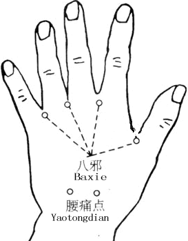 鱼腰按压疼痛什么原因(鱼腰按着酸痛什么原因) - 鑫光知识网