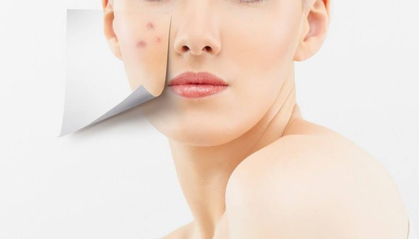 红蓝光祛痘对比图