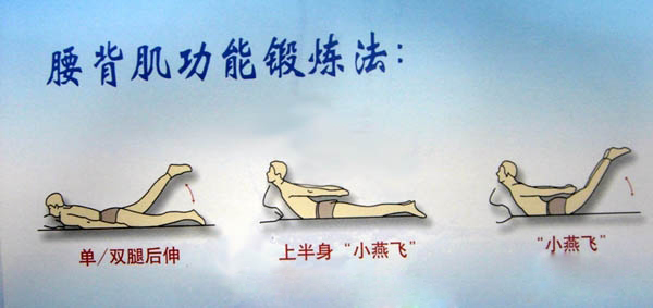 腰椎间盘突出症的锻炼方法又学到了新知识了