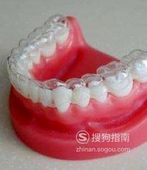 牙套矫正牙齿大概多少钱 牙齿矫正：[7]带牙套多少钱？我的整牙价格
