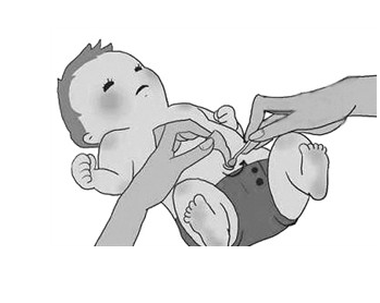 如何护理新生儿的肚脐部 如何护理新生儿的肚脐