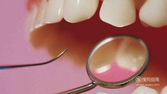 牙齿矫正期间牙龈增生怎么办 矫正期间牙龈增生怎么办？首发